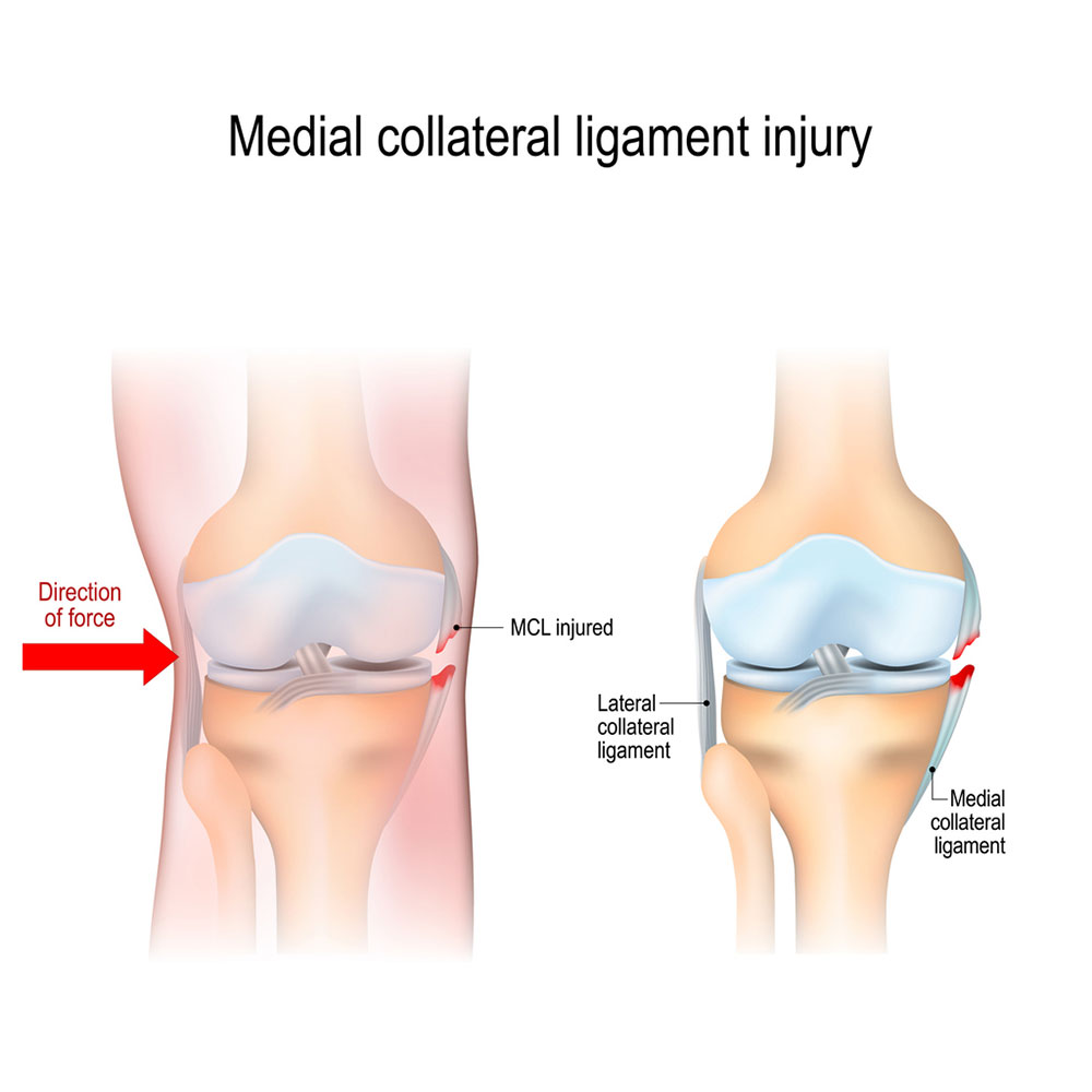 Young athlete with knee injury