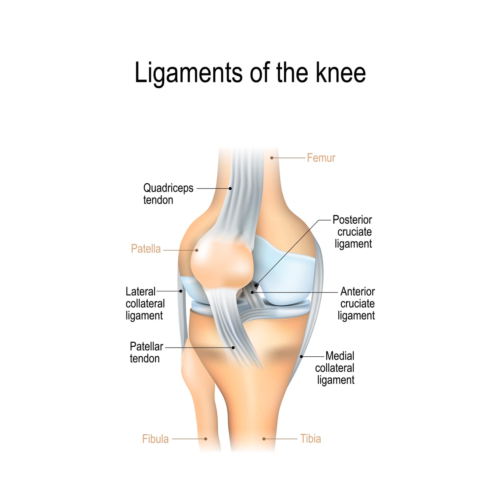 ACL tears and injuries