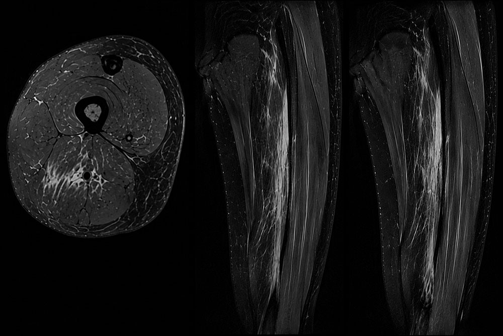 Online sports injury assessment