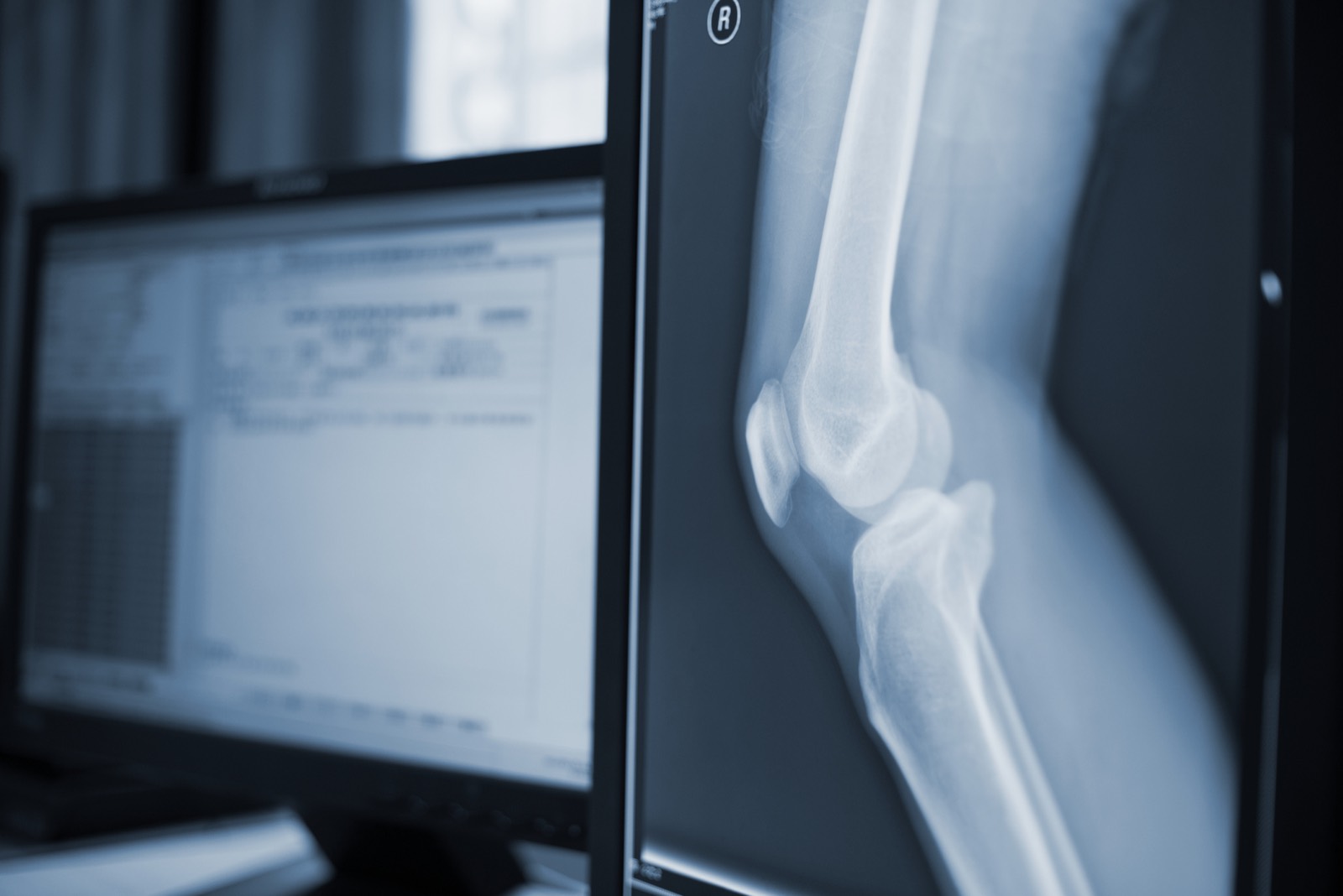 Orthopaedic specialist reviewing a knee X-ray and imaging on screen