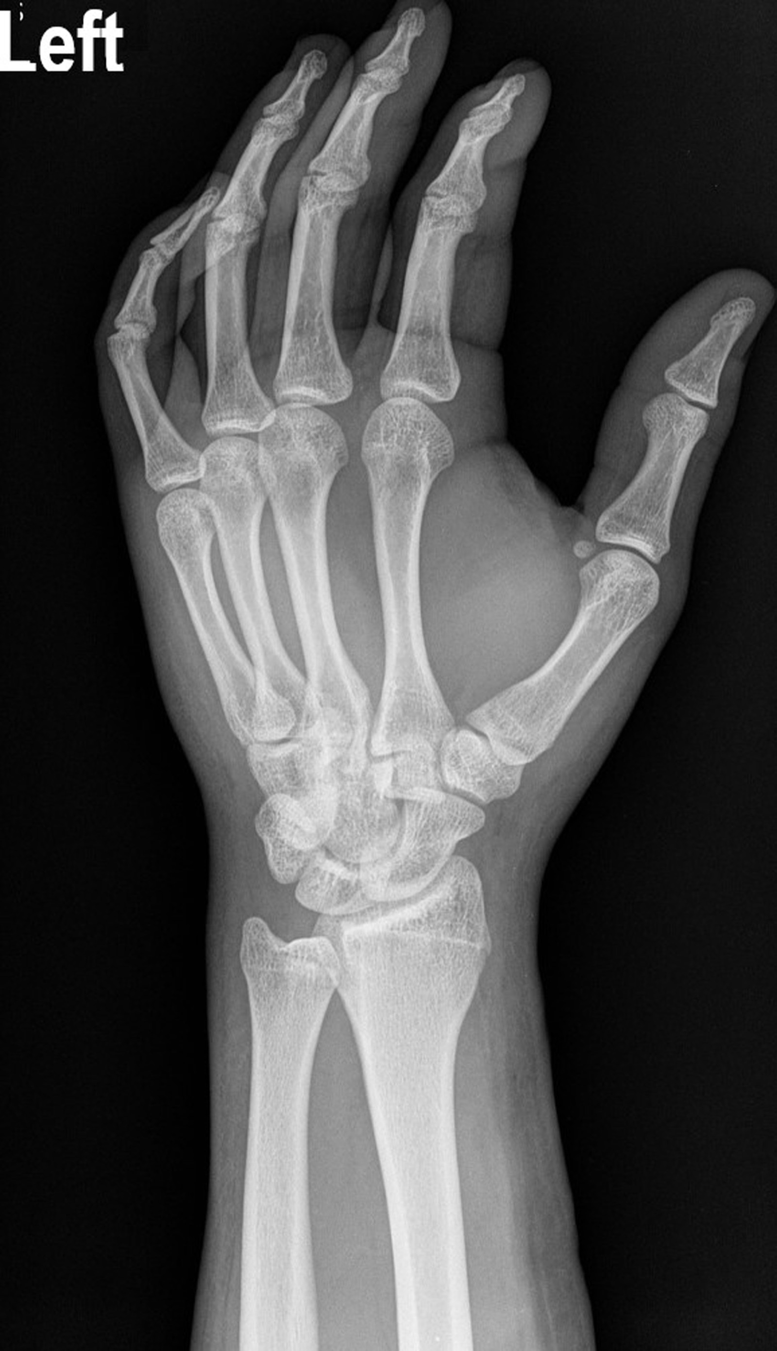 Orthopaedic specialist reviewing a wrist fracture X-ray online